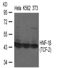 HNF-1β(TCF-2) Antibody