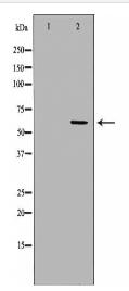 PPP3CA Antibody