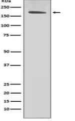 ErbB2 (HER2) Antibody