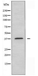 NT5C3 Antibody