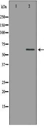 PAK1 Antibody