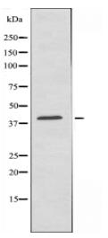 MTR1B Antibody