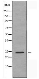 HOXA7 Antibody