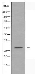 RPL7L1 Antibody