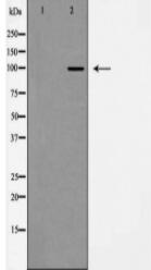 GluR2/3 Antibody