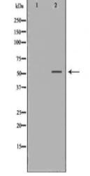MMP13 Antibody