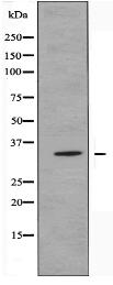 OR52D1 Antibody