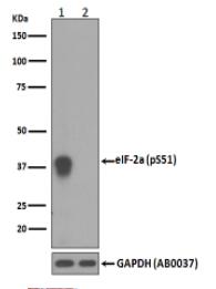 Phospho-EIF2S1 (S51) Antibody