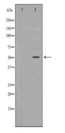 MEF2C Antibody