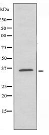 SLC9A3R2 Antibody