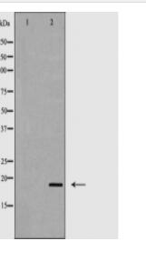 CD3 ζ Antibody