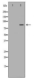 PFKM Antibody