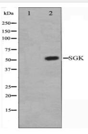 SGK Antibody