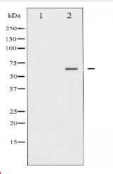 NF-kappaB p65 Antibody