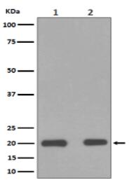 CEBP Beta Antibody