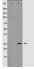 NGF beta Antibody