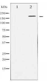 HER2 Antibody