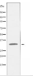 PRKY Antibody