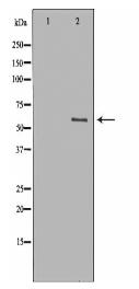 PKM2 Antibody