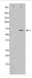 TGFBI Antibody