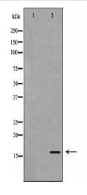 TTR Antibody