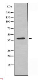 LMX1B Antibody