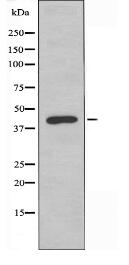 OR2AJ1 Antibody