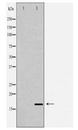 NPPA Antibody