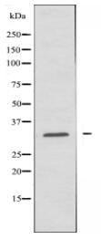 MRPL24 Antibody