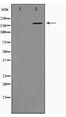 Collagen XIalpha 1 Antibody