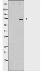 TOP3B Antibody