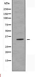 OR52E6 Antibody