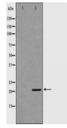KRAS Antibody