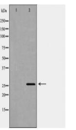 LGALS3 Antibody