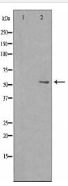 HTR2B Antibody