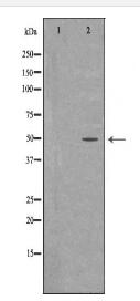 PTPN2 Antibody