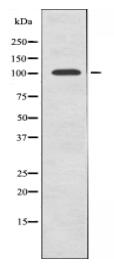 LRP8 Antibody