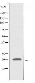 MRPS25 Antibody