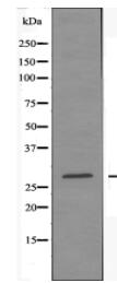 NDUFV2 Antibody