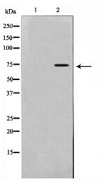 IL-2Rbeta/CD122 Antibody