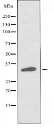 OR5M11 Antibody