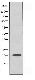 RPL11 Antibody