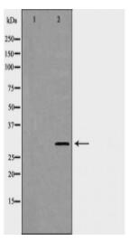 KLK2 Antibody