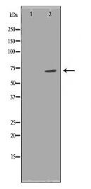 ZAP70 Antibody