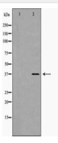 LUM Antibody