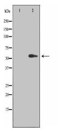 TINF2 Antibody