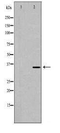 TNNT2 Antibody