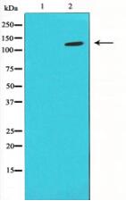 HIF1A antibody