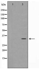 TTF2 Antibody