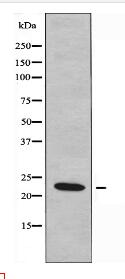 RGS1 Antibody